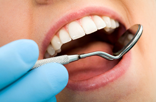 dental fillings in pasadena